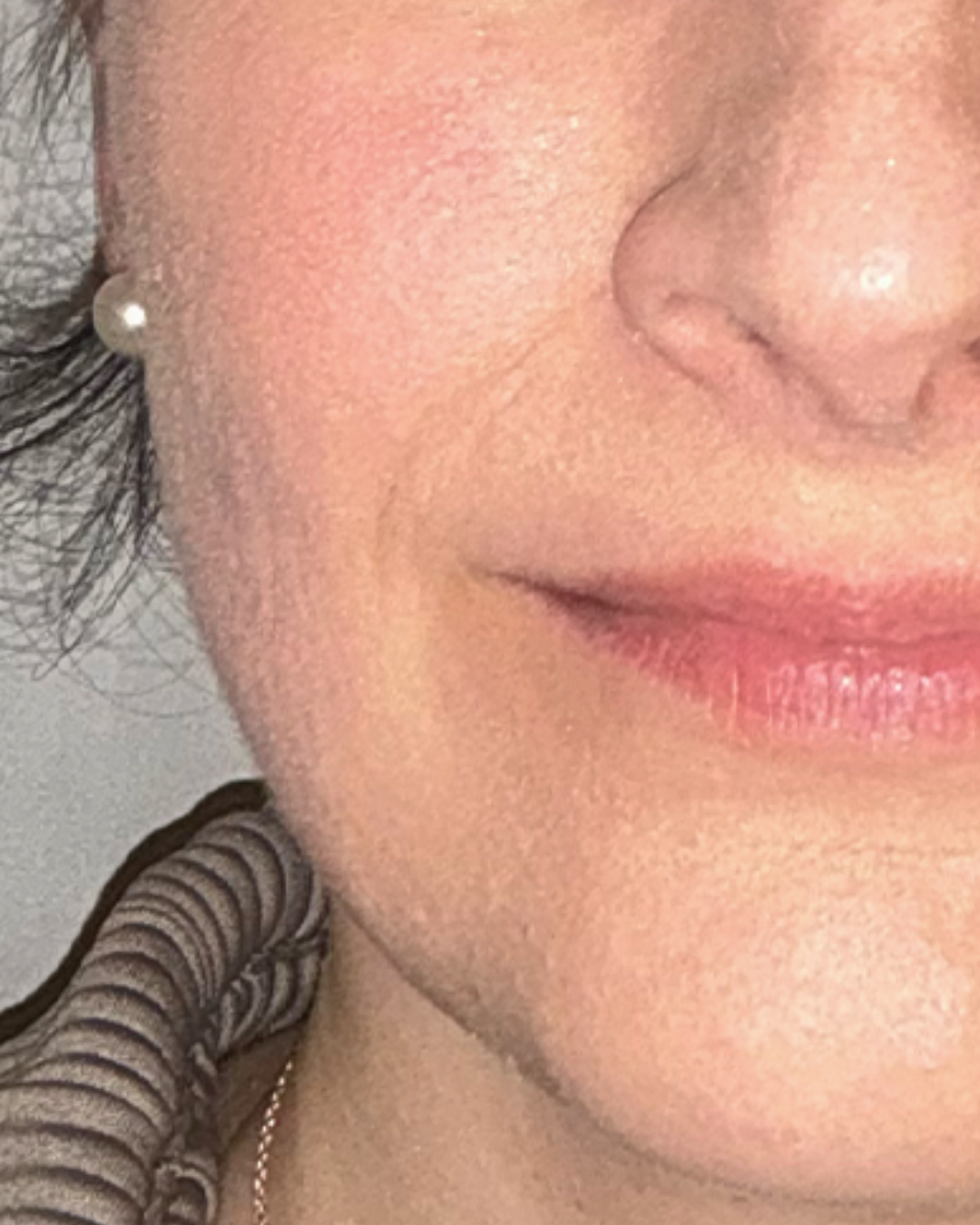 Before treatment