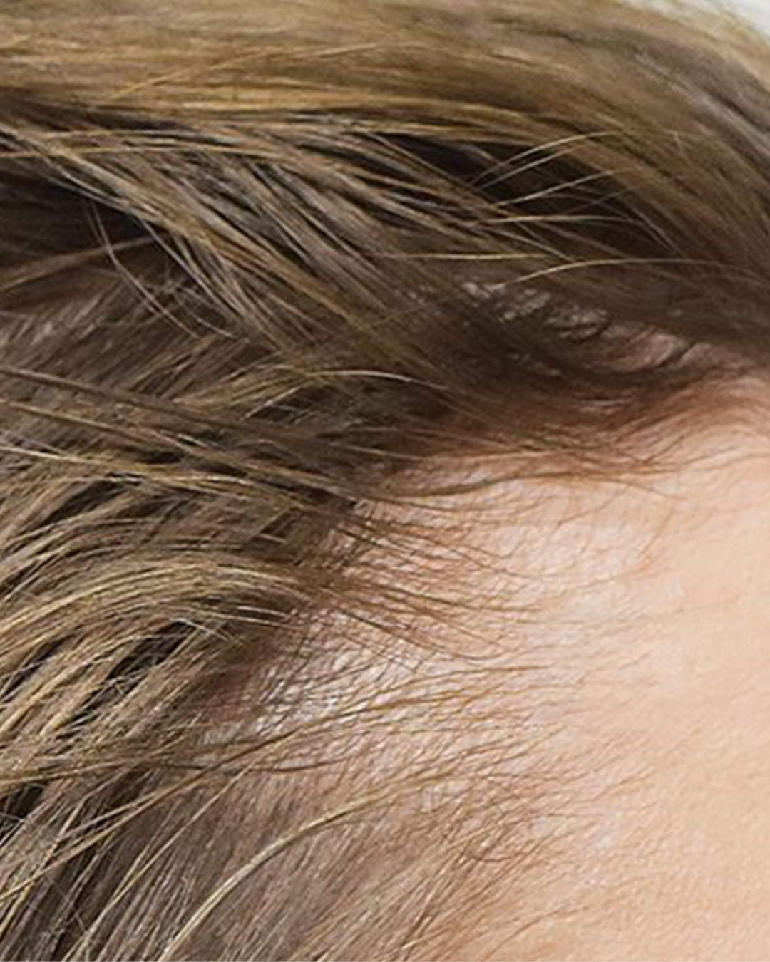 Before treatment